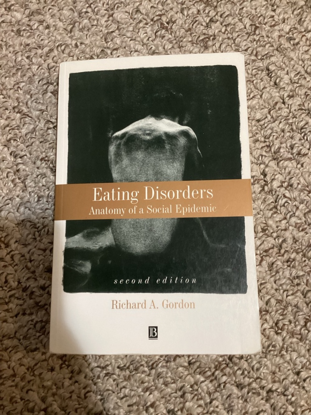 Eating Disorders: Anatomy of a Social Epidemic - Richard Gordon - Softcover